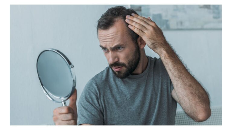 Hair loss worries
