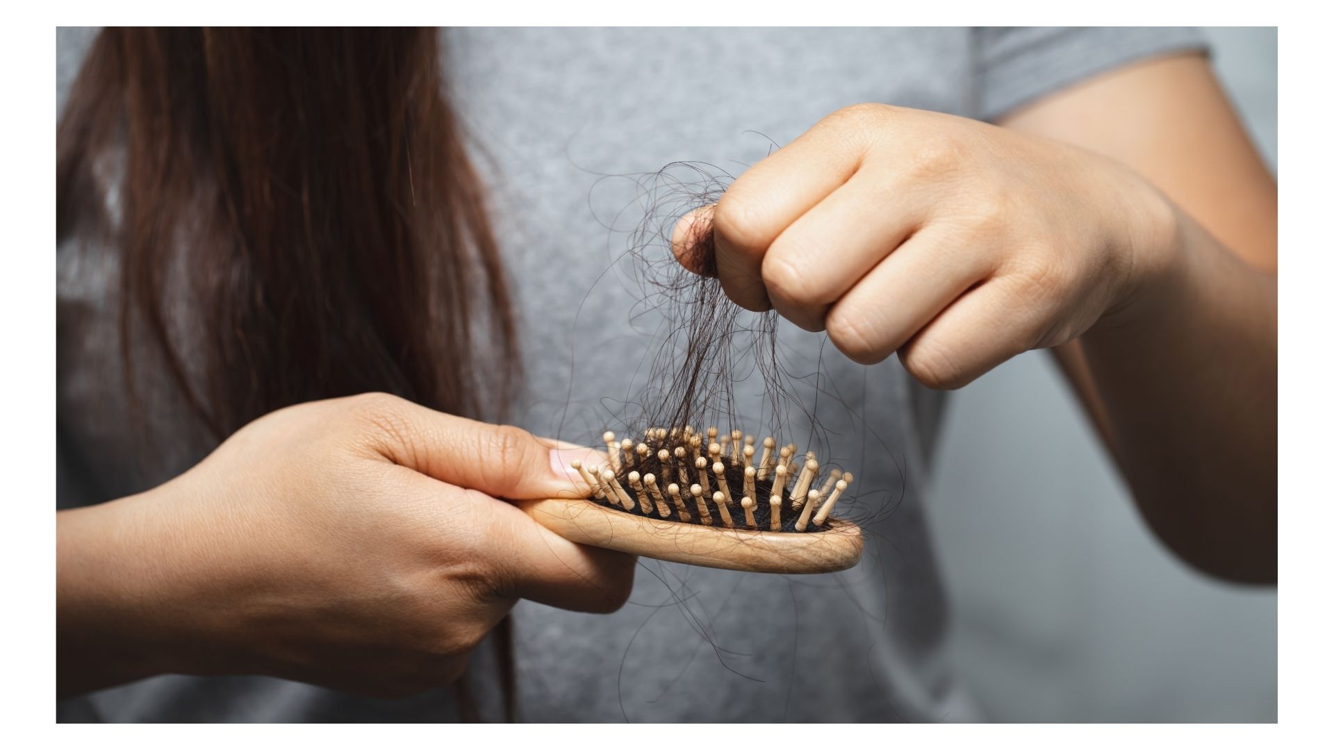 Hair Loss
